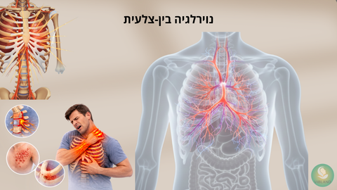 נוירלגיה בין-צלעית